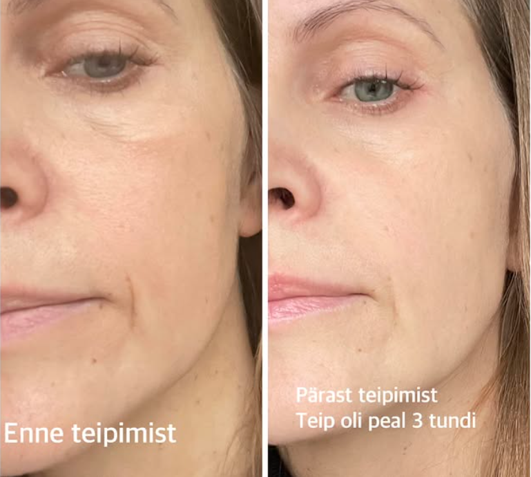 Esteetilise iluteipimise koolitus sõbrannadega KOLMELE! - Image 2